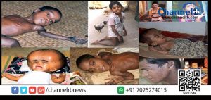 Read more about the article നീതിക്കായി നെട്ടോട്ടം: എന്‍ഡോസള്‍ഫാന്‍ ദുരിത ബാധിതര്‍ക്ക് അഞ്ച് ലക്ഷം രൂപ വീതം നഷ്ട പരിഹാരം നല്‍കാന്‍ സുപ്രീം കോടതി വിധി.