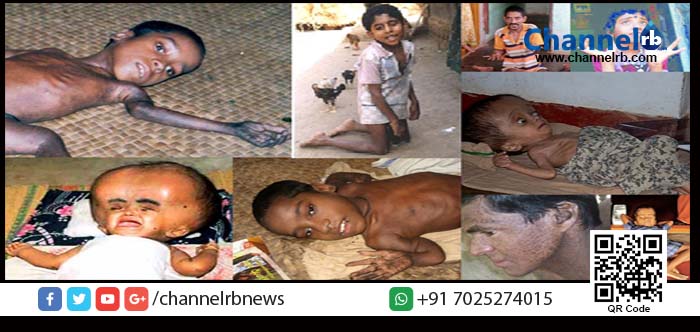 You are currently viewing നീതിക്കായി നെട്ടോട്ടം: എന്‍ഡോസള്‍ഫാന്‍ ദുരിത ബാധിതര്‍ക്ക് അഞ്ച് ലക്ഷം രൂപ വീതം നഷ്ട പരിഹാരം നല്‍കാന്‍ സുപ്രീം കോടതി വിധി.