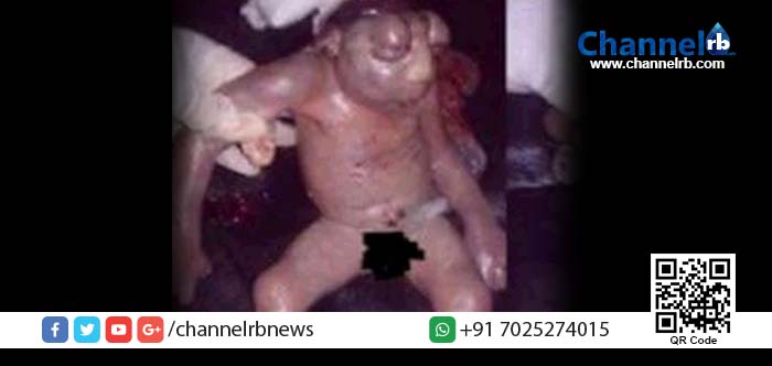 Read more about the article കാലം കലി കാലം; അങ്ങനെ ഒരു മനുഷ്യ സ്ത്രീ തവളക്കുഞ്ഞിനെയും പ്രസവിച്ചു!