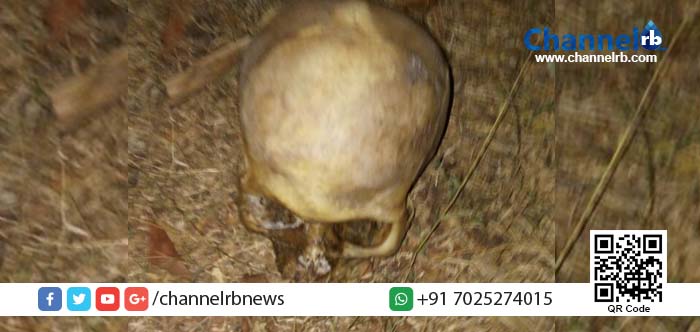 You are currently viewing കാസര്‍കോട് തെങ്ങിന്‍ പറമ്പില്‍ മനുഷ്യന്റെ തലയോട്ടി കണ്ടെത്തി.