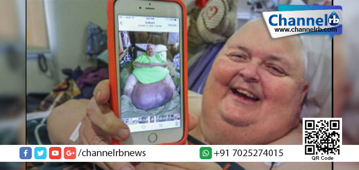 You are currently viewing 57 കാരന്റെ വയറ്റില്‍ നിന്ന് നീക്കം ചെയ്തത് 59 കിലോ തൂക്കമുള്ള മുഴ.