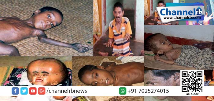 You are currently viewing എന്‍ഡോസള്‍ഫാന്‍ ദുരിതബാധിതര്‍ക്കുള്ള നഷ്ടപരിഹാരത്തിന്റെ മൂന്നാം ഗഡു ഈമാസം വിതരണം ചെയ്യും.