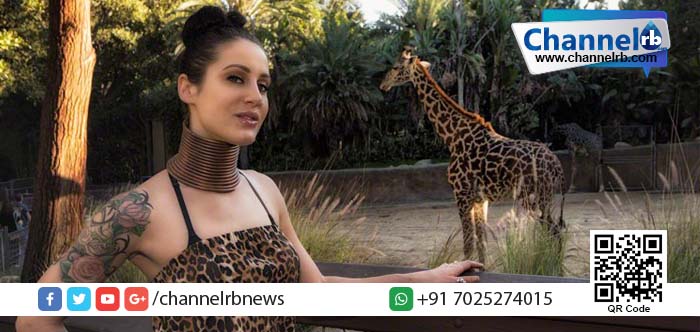 You are currently viewing കഴുത്ത് നീളാനായി റിങ്ങിട്ടു. അവസാനം റിങ് ഊരിയപ്പോള്‍ ഞെട്ടിപ്പോയി…