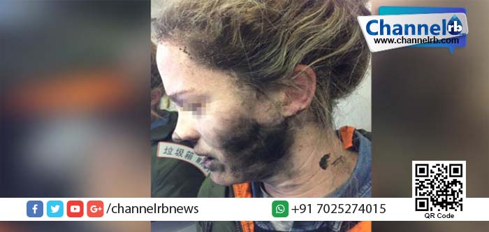 You are currently viewing ഹെഡ്‌ഫോണ്‍ പൊട്ടിത്തെറിച്ച് യുവതിക്ക് പരിക്ക്.