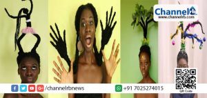 Read more about the article മുടിക്കുമുണ്ട് കൈയ്യും കാലും രൂപവുമൊക്കെ…!