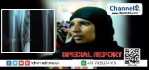 Read more about the article കാസർകോട് ജനറൽ ആശുപത്രിയിൽ ഫിസിയോ തെറാപ്പിക്കിടെ എൻഡോസർഫാൻ ബാധിതനായ കുട്ടിയുടെ കൈയും കാലും ഒടിഞ്ഞതായുള്ള ആരോപണം; സര്‍ക്കാര്‍ ധനസഹായം  ലക്ഷ്യമാക്കിയുള്ള നീക്കം