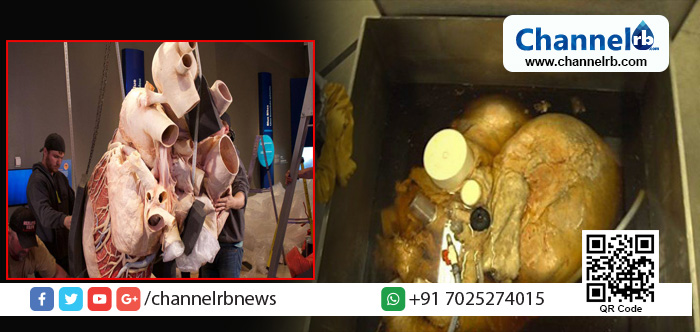 You are currently viewing ലോകത്തിലെ ഏറ്റവും വലിയ ഹൃദയം നിങ്ങള്‍ കണ്ടിട്ടുണ്ടോ?