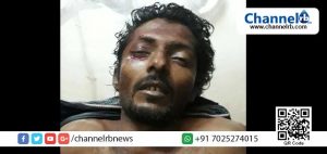 Read more about the article മേല്‍പറമ്പില്‍ വഴിയാത്രക്കാരന്‍ കാറിടിച്ച് മരിച്ചു