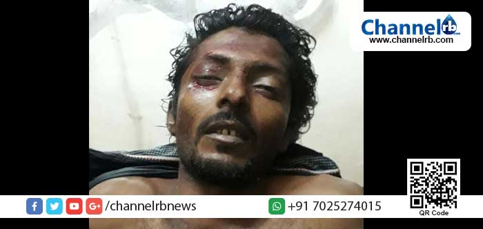 You are currently viewing മേല്‍പറമ്പില്‍ വഴിയാത്രക്കാരന്‍ കാറിടിച്ച് മരിച്ചു