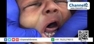 Read more about the article അഹമ്മദാബാദില്‍ അത്ഭുതമായി നവജാതശിശു പിറന്നു. അമ്പരപ്പോടെ ശാസ്ത്രലോകം.