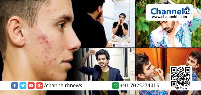 Read more about the article വെളുക്കാന്‍ ഉള്ള ക്രീം വാങ്ങി ഉപയോഗിച്ചു; കാസർകോട് ജില്ലയില്‍ നൂറിലേറെ പേർ ചികിത്സയിൽ