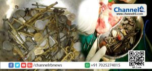 Read more about the article മധ്യപ്രദേശുകാരനായ യുവാവിന്റെ വയറിനുള്ളില്‍ നിന്ന് ശസ്ത്രക്രിയ വഴി പുറത്തെടുത്തത് 263 നാണയങ്ങളും100 ആണികളും അടക്കം അഞ്ച്കിലോയുടെ ഇരുമ്പ്; അത്ഭുതത്തോടെ ഡോക്ടര്‍മാര്‍