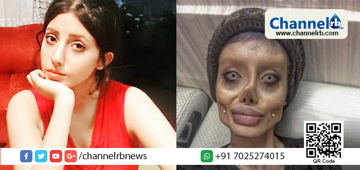 You are currently viewing ആഞ്ജലീന ജോളിയാകാൻ പ്ലാസ്റ്റിക്ക് സര്‍ജറി ചെയ്ത പെണ്‍കുട്ടിയുടെ ഇപ്പോഴത്തെ അവസ്ഥ; പ്രചരിക്കുന്ന ചിത്രത്തിലെ സത്യം എന്തെന്ന് പെണ്‍കുട്ടി വെളിപ്പെടുത്തുന്നു