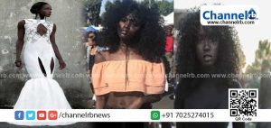 Read more about the article കറുത്ത ശരീരവും ചുരുണ്ട തലമുടിയും; ഈ 19 കാരിയെ ഒറ്റനോട്ടത്തിൽ കണ്ടാൽ ഒന്ന് തുറിച്ച് നോക്കി അകറ്റി നിർത്തും; ഇവളാണോ..? ലോകത്ത് ഏറ്റവും കൂടുതല്‍ പ്രതിഫലം കൈപ്പറ്റുന്ന മോഡൽ