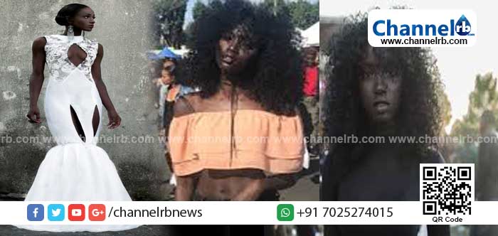 You are currently viewing കറുത്ത ശരീരവും ചുരുണ്ട തലമുടിയും; ഈ 19 കാരിയെ ഒറ്റനോട്ടത്തിൽ കണ്ടാൽ ഒന്ന് തുറിച്ച് നോക്കി അകറ്റി നിർത്തും; ഇവളാണോ..? ലോകത്ത് ഏറ്റവും കൂടുതല്‍ പ്രതിഫലം കൈപ്പറ്റുന്ന മോഡൽ