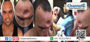 Read more about the article എതിരാളിയുടെ കൈമുട്ടുകൊണ്ടുള്ള ഇടിയേറ്റു; ബോക്‌സിങ് മത്സരത്തിനിടെ താരത്തിന്റെ നെറ്റി തകര്‍ന്നു