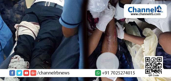 You are currently viewing കണ്ണൂരില്‍ സര്‍വകക്ഷി സമാധാനയോഗ തീരുമാനവും കാറ്റില്‍ പറന്നു; പാനൂര്‍ കുറ്റേരിയില്‍ സി.പി.എം പ്രവര്‍ത്തകന് വെട്ടേറ്റു