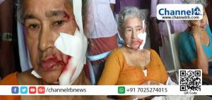 Read more about the article പയ്യന്നൂരിലും പരിസരപ്രദേശങ്ങളിലും പേപ്പട്ടിയുടെ വിളയാട്ടം; വഴിയില്‍ നില്‍ക്കുകയായിരുന്ന18 പേരെ ആക്രമിച്ചു