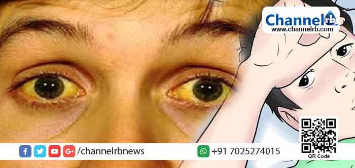 You are currently viewing മഞ്ഞപ്പിത്തത്തിനെതിരെ ജാഗ്രത പാലിക്കാന്‍ ആരോഗ്യവകുപ്പിൻ്റെ നിര്‍ദ്ദേശം; ഭക്ഷണ സാധനങ്ങള്‍ ചൂടോടെ ഉപയോഗിക്കണം