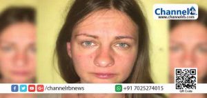 Read more about the article വിദേശവനിത ലിഗയുടെ പോസ്റ്റ്‌മോര്‍ട്ടം റിപ്പോര്‍ട്ടിലെ കൂടുതല്‍ വിവരങ്ങള്‍ പുറത്തുവന്നു; ലൈംഗിക പീഡനത്തിനിരയായിട്ടില്ല; കൊലപാതകമെന്ന് ഉറപ്പിച്ചുപറയാനാകാതെ പോലിസും