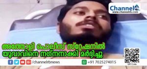 Read more about the article സംസ്ഥാനത്ത് വീണ്ടും മൂന്നാംമുറ; കോഴിക്കോട് അത്തോളി പൊലീസ് സ്റ്റേഷനില്‍ യുവാവിനെ നഗ്നനാക്കി മര്‍ദ്ദിച്ചതായി പരാതി