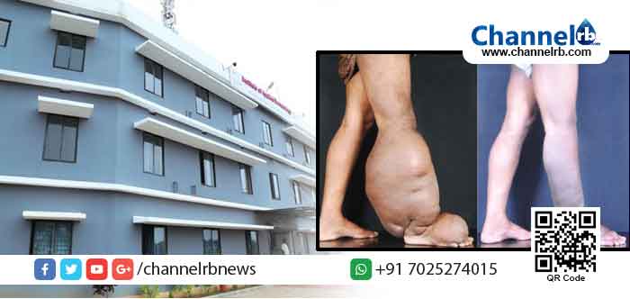 You are currently viewing നെതര്‍ലന്‍ഡ്‌സില്‍ നടക്കുന്ന എട്ടാം അന്താരാഷ്ട്ര ലിംഫഡീമ ഫ്രെയിംവര്‍ക് സമ്മേളനത്തില്‍ കാസര്‍കോട്ടെ ഐ.എ.ഡി സ്ഥാപനവും പങ്കെടുക്കും