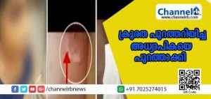 Read more about the article രണ്ടാം ക്ലാസുകാരിയോട് രണ്ടാനമ്മ ചെയ്ത കൊടും ക്രൂരത പുറത്തറിയിച്ച അധ്യാപികയെ സ്‌കൂളില്‍ നിന്നും പുറത്താക്കി