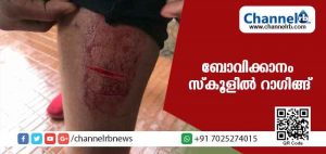 Read more about the article ബോവിക്കാനം സ്‌കൂളില്‍ റാഗിങ്ങ്; മൂന്ന് വിദ്യാര്‍ത്ഥികള്‍ക്ക് പരിക്ക്