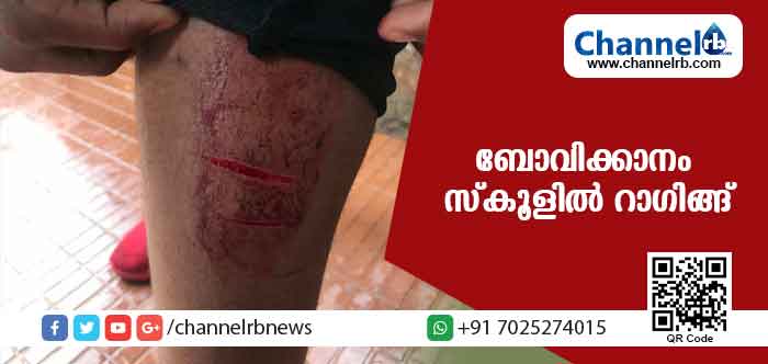 You are currently viewing ബോവിക്കാനം സ്‌കൂളില്‍ റാഗിങ്ങ്; മൂന്ന് വിദ്യാര്‍ത്ഥികള്‍ക്ക് പരിക്ക്