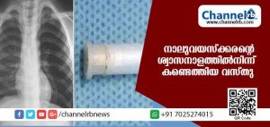 Read more about the article വിചിത്രമായ ചുമയുമായി എത്തിയ നാലുവയസ്‌ക്കരൻ്റെ ശ്വാസനാളത്തില്‍ നിന്ന് കണ്ടെത്തിയ വസ്തു