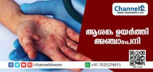 Read more about the article ജനങ്ങളില്‍ ആശങ്ക ഉയര്‍ത്തി  അഞ്ചാംപനി