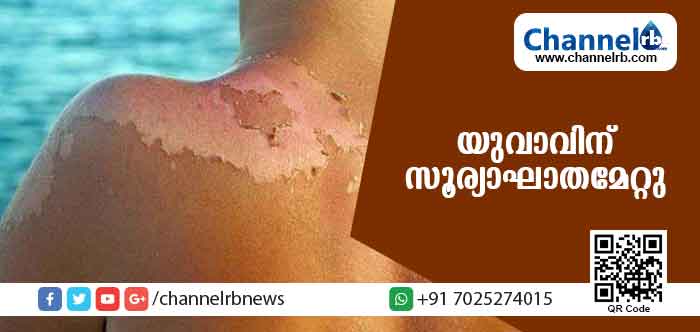 You are currently viewing കനത്ത ചൂട്; ബന്തടുക്കയിലെ യുവാവിന് സൂര്യാഘാതമേറ്റു