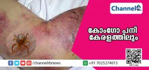 Read more about the article നിപ്പയ്ക്ക് പിന്നാലെ കോംഗോ പനി കേരളത്തിലും: മലപ്പുറം സ്വദേശി തൃശൂരില്‍ ചികിത്സയില്‍