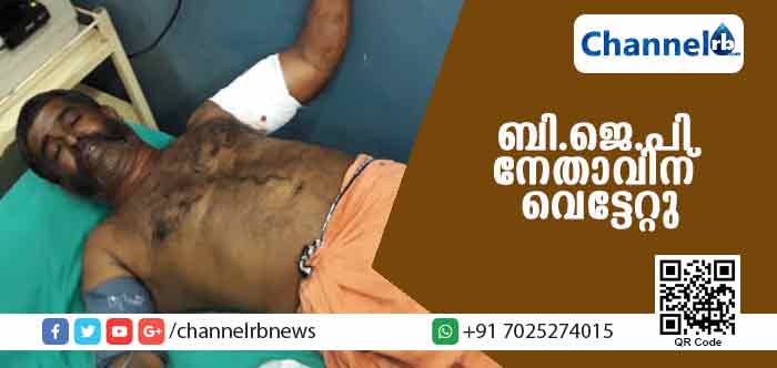 Read more about the article കാസര്‍കോട്ട് പട്ടാപ്പകല്‍ ബി.ജെ.പി നേതാവിന് വെട്ടേറ്റു