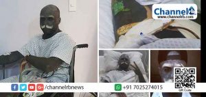 Read more about the article ടാറ്റൂ ചെയ്തപ്പോൾ ശരീരത്തില്‍ അഭംഗിയായി തോന്നിയത് സ്വന്തം ജനനേന്ദ്രിയ൦; ഉടൻ യുവാവ് അതും നീക്കം ചെയ്തു