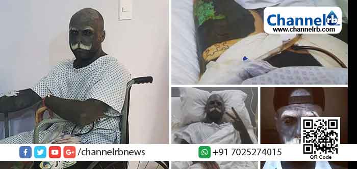 You are currently viewing ടാറ്റൂ ചെയ്തപ്പോൾ ശരീരത്തില്‍ അഭംഗിയായി തോന്നിയത് സ്വന്തം ജനനേന്ദ്രിയ൦; ഉടൻ യുവാവ് അതും നീക്കം ചെയ്തു