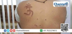 Read more about the article തിഹാര്‍ ജയിലില്‍ മുസ്‌ലിം തടവുകാരന്‍റെ ദേഹത്ത് പഴുപ്പിച്ച ലോഹത്താല്‍ ‘ഓം’ വരച്ചു; ജയില്‍ അധികൃതരില്‍ നിന്നും ഏല്‍ക്കേണ്ടി വന്നത് ക്രൂരമര്‍ദ്ദനം