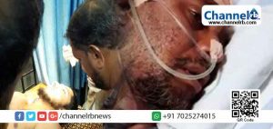 Read more about the article കാസര്‍കോട് മദ്റസ അധ്യാപകന്‍ കരിം മുസ്‌ലിയാരെ വധിക്കാന്‍ ശ്രമിച്ച കേസിലെ രണ്ടാം പ്രതിക്ക് വെട്ടേറ്റു