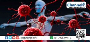 Read more about the article ഈ 7 പരിശോധനകൾ നടത്തിയാല്‍ ശരീരത്തിൽ എവിടെയെങ്കിലും ക്യാൻസർ ഉണ്ടെങ്കില്‍ തിരിച്ചറിയാം