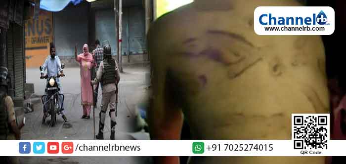 You are currently viewing മര്‍ദ്ദനം, ഇലക്ട്രിക് ഷോക്ക്; കാശ്മീരില്‍ നടക്കുന്നത്  ഇന്ത്യന്‍ സൈന്യത്തിന്‍റെ അതിക്രമമോ? ആക്രമണത്തിന്‍റെ ഇരകള്‍ സംസാരിക്കുന്ന വീഡിയോ പുറത്തുവിട്ട് ബി.ബി.സി