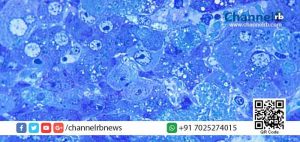 Read more about the article വൈ​റ​ല്‍ പ​നി; ക​ണ്ണൂ​രി​ല്‍ ആ​റ് വി​ദ്യാ​ര്‍​ഥി​ക​ള്‍ കൂ​ടി ആ​ശു​പ​ത്രി​യി​ല്‍; നി​രീ​ക്ഷ​ണ​ത്തി​ലു​ള്ള വി​ദ്യാ​ര്‍​ഥി​ക​ളുടെ എ​ണ്ണം ഇതോടെ പ​തി​നൊ​ന്നാ​യി