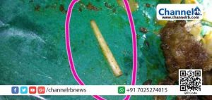 Read more about the article ഹോട്ടലിലെ ബീഫ് ഫ്രൈയില്‍ നിന്നും കിട്ടിയ എല്ല് പട്ടിയുടേതോ? നിഗൂഢതയ്ക്ക് അവസാനം; പരിശോധനാ റിപ്പോര്‍ട്ട് പുറത്ത്