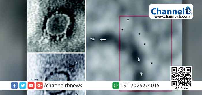 Read more about the article കോവിഡ്19 യുടെ ഇന്ത്യയില്‍ നിന്നുള്ള ആദ്യ ഇലക്‌ട്രോണ്‍ മൈക്രോസ്‌കോപ് ചിത്രത്തിന് വുഹാനിലെ വൈറസുമായി സാമ്യം