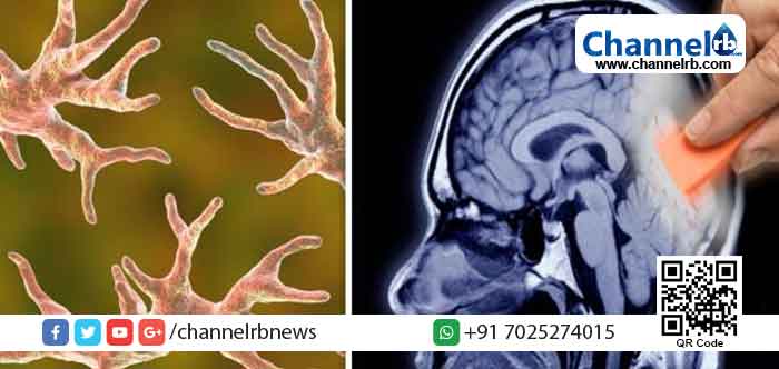 Read more about the article തലച്ചോര്‍ ഭക്ഷിക്കുന്ന സൂക്ഷ്മ ജീവികള്‍; യു.എസില്‍ ആറു വയസ്സുകാരന്‍ മരിച്ചു; ആരോഗ്യ ദുരന്തമായി പ്രഖ്യാപിച്ച്  കനത്ത ജാഗ്രത