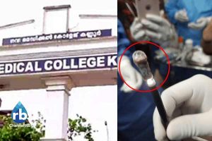 Read more about the article വിട്ടു മാറാത്ത ചുമയും അനുബന്ധ ബുദ്ധിമുട്ടും; ആസ്ത്മാ രോഗമായി കരുതപ്പെട്ട് കാലം ഇത്രയും മരുന്ന് കഴിച്ചു; വിശദമായ പരിശോധനക്കൊടുവിൽ ശ്വാസനാളിയിലെ തടസ്സം നീക്കിയപ്പോൾ കണ്ണൂരിലെ നാല്‍പത് വയസ്സുകാരിയും ഡോക്ടറും ഞെട്ടി