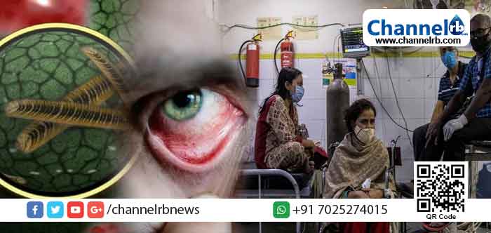 Read more about the article അപൂർവവും എന്നാൽ മാരകവും;ബ്ലാക്ക് ഫംഗസ് പകർച്ചവ്യാധിയായി പ്രഖ്യാപിക്കണമെന്ന് രാജ്യത്തെ  സംസ്ഥാനങ്ങളോട് കേന്ദ്രസര്‍ക്കാര്‍