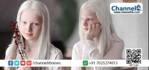 Read more about the article ഇത് ഫോട്ടോയിൽ എഡിറ്റിങ് വരുത്തിയതല്ല; കണ്ടാല്‍ ഒരു കുട്ടി എന്നാൽ യഥാർത്ഥത്തിൽ…?