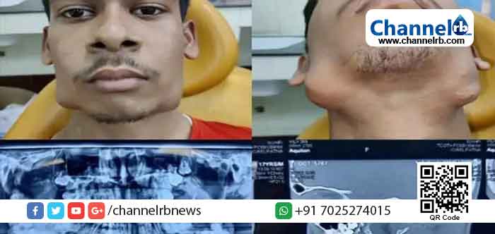 You are currently viewing വായിലുള്ളത് 82 പല്ലുകള്‍; അപൂര്‍വ രോഗാവസ്ഥയുമായി ഒരു കൗമാരക്കാരന്‍