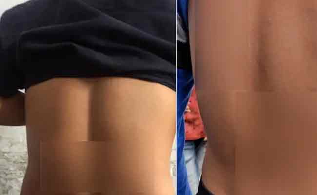 Read more about the article ക്ലാസിലിരുന്ന് വിസിലടിച്ചതിന് 40 വിദ്യാർത്ഥികൾക്ക് ക്രൂരമർദ്ദനം; പരാതിപെട്ടാൽ അധ്യാപികയെ പീഡിപ്പിച്ചെന്ന കേസിൽ അകത്താക്കുമെന്ന് അധ്യാപകരുടെ ഭീഷണി