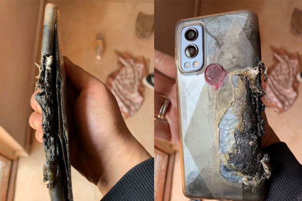 You are currently viewing സ്മാർട് ഫോൺ  പൊട്ടിത്തെറിച്ച് യുവാവിന് ഗുരുതര പൊള്ളലേറ്റു; അനന്തരഫലം അനുഭവിക്കാന്‍ തയ്യാറായിക്കോളൂ എന്ന് വണ്‍പ്ലസ് കമ്പനിയോട് മുന്നറിയിപ്പ്